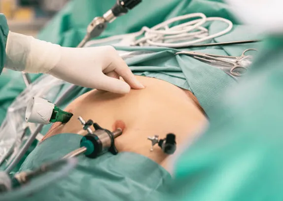 Bariatric Surgery