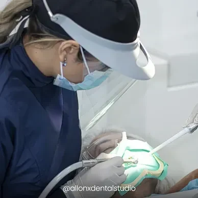 All On X Dental Studio - Image 7