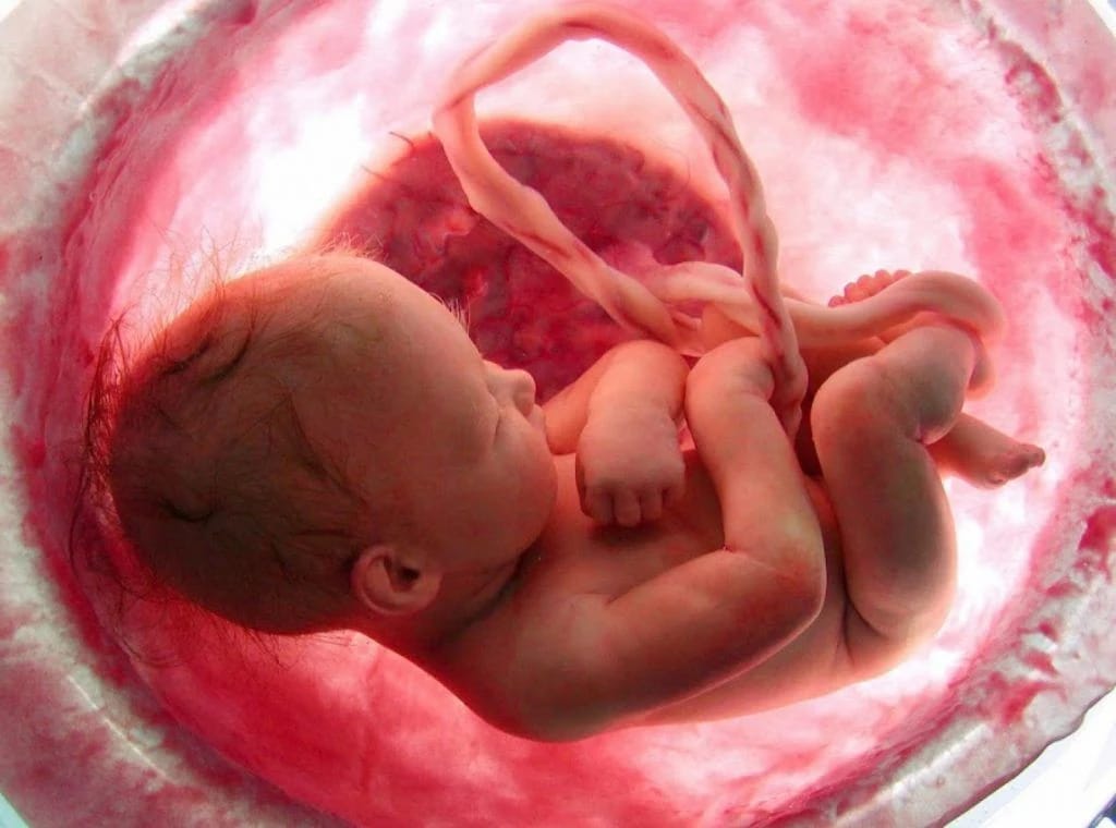 Umbilical Cord vs. Adipose-Derived Stem Cells: Choosing Your Path to Recovery